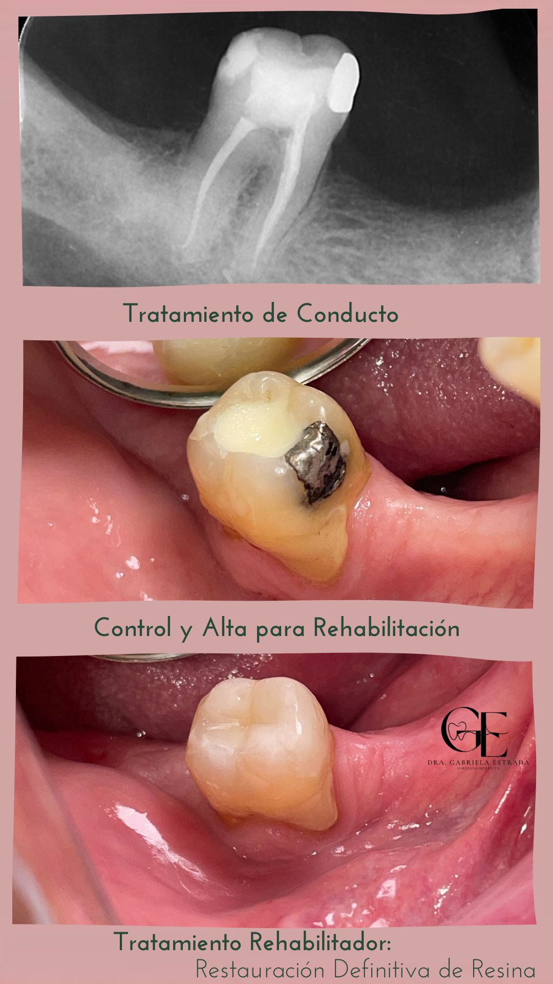 Gabriela Estrada Mura-23