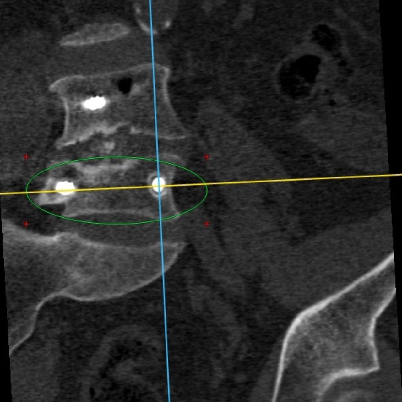David Tafur Muñoz-1341