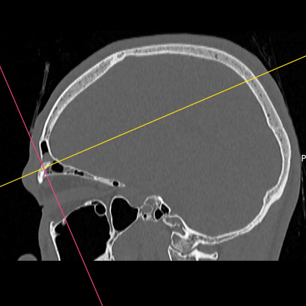 David Tafur Muñoz-1733