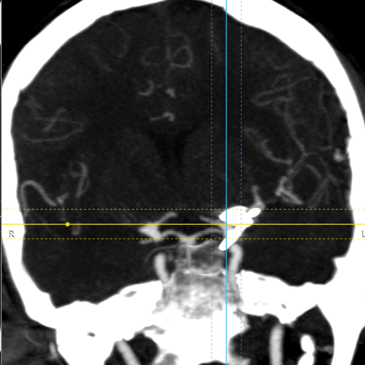 David Tafur Muñoz-1699