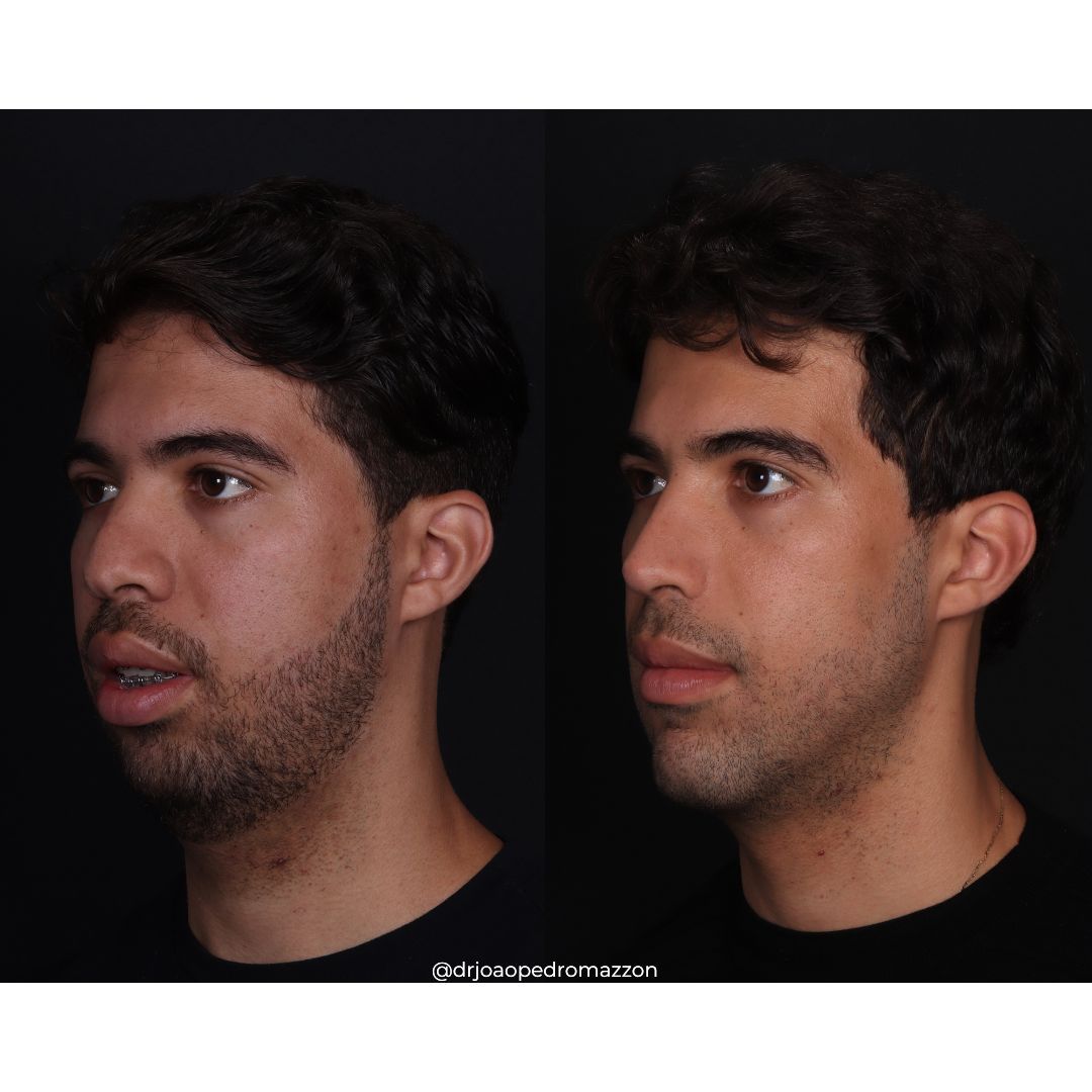 João Pedro Paulino Mazzon-44