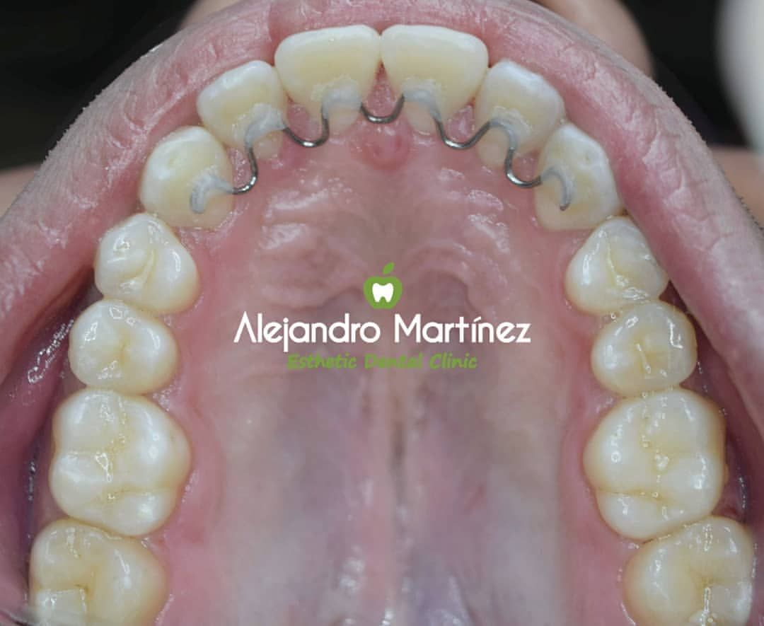 Alejandro Martinez-4