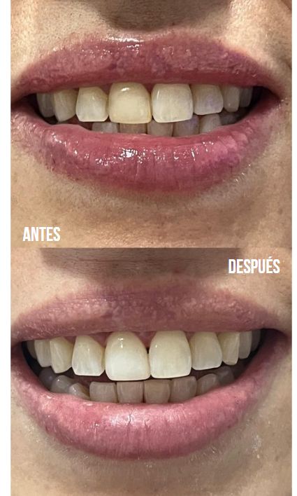 Juliana Gallego Quintero-6