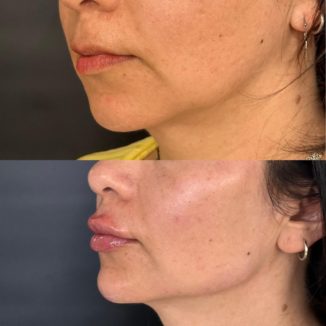 Andrés Felipe Barreto Galeano-20