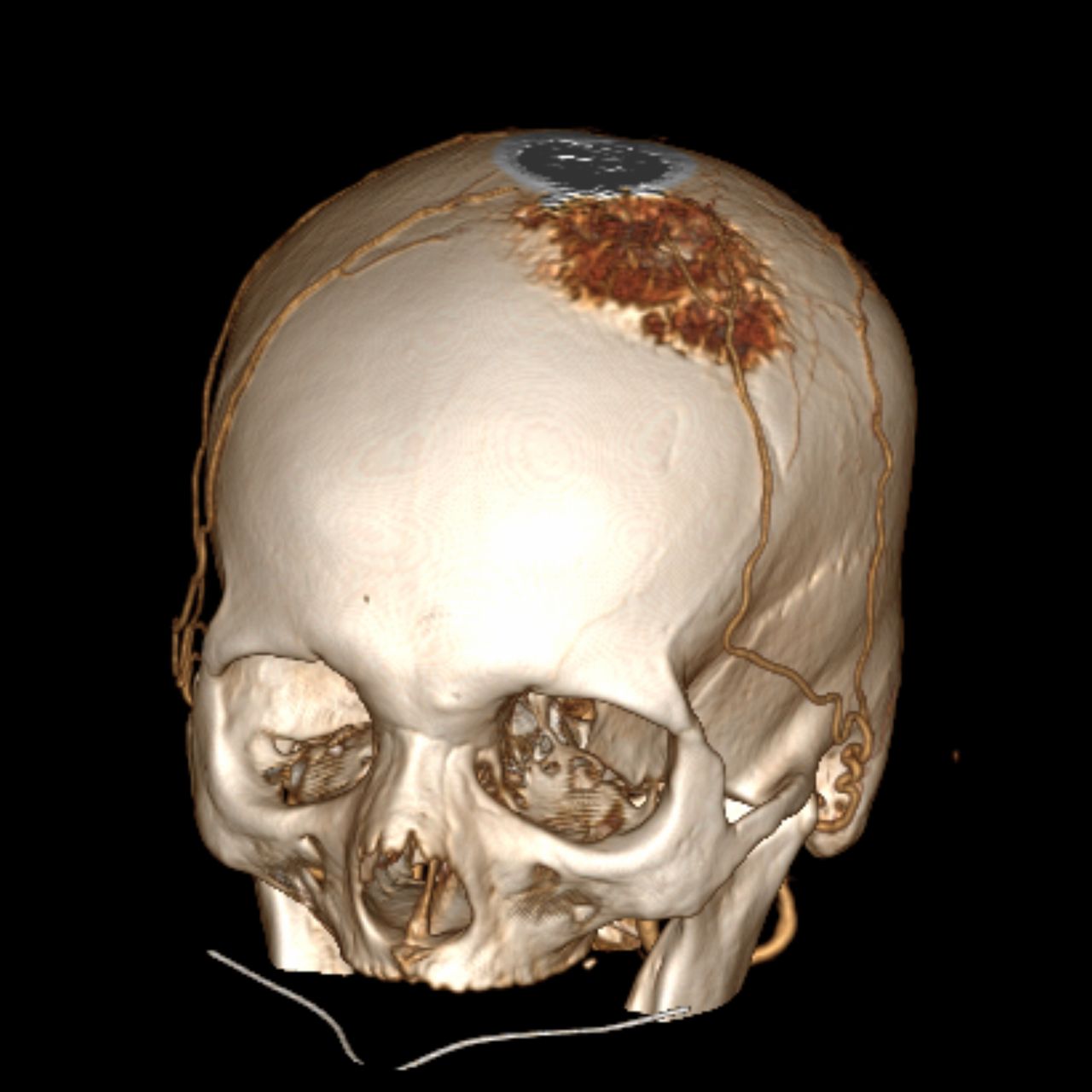 David Tafur Muñoz-1286