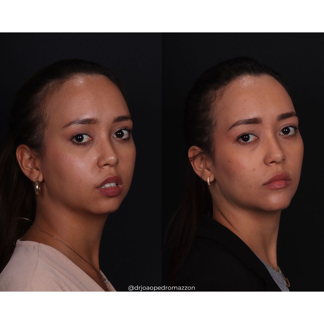 João Pedro Paulino Mazzon-38