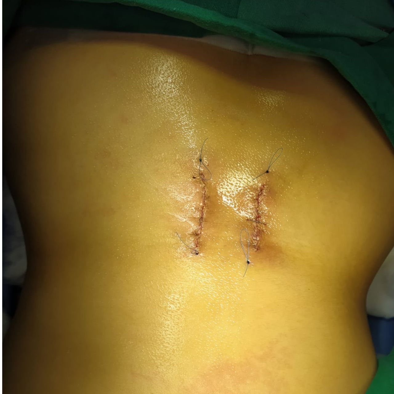 David Tafur Muñoz-1246