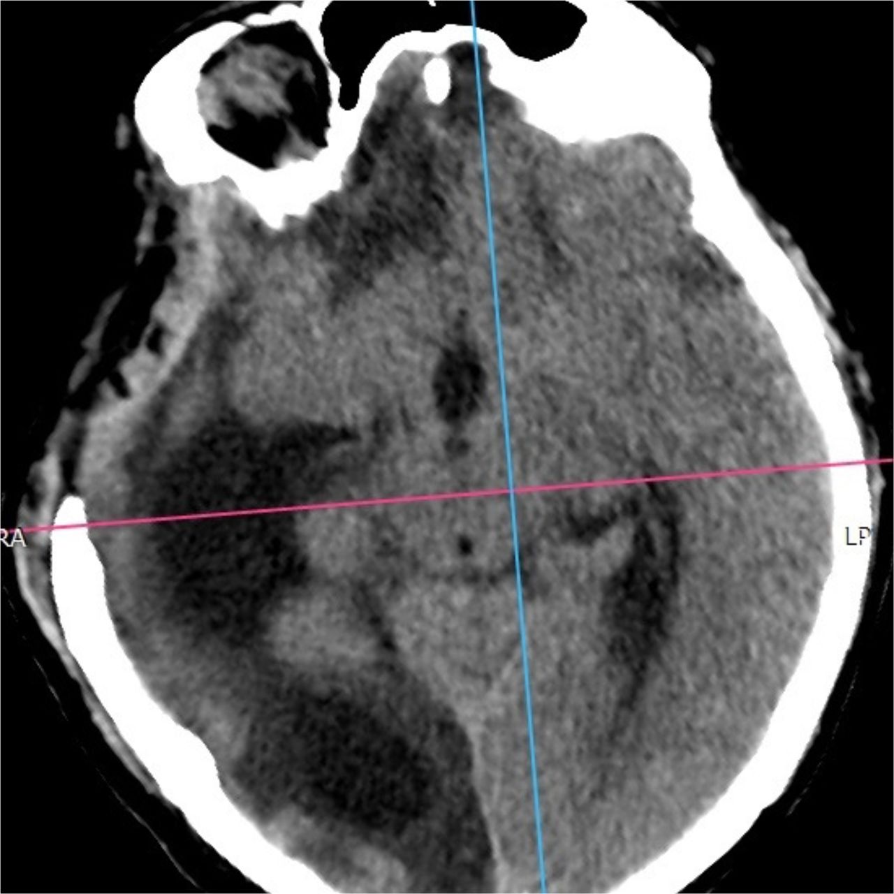 David Tafur Muñoz-1389