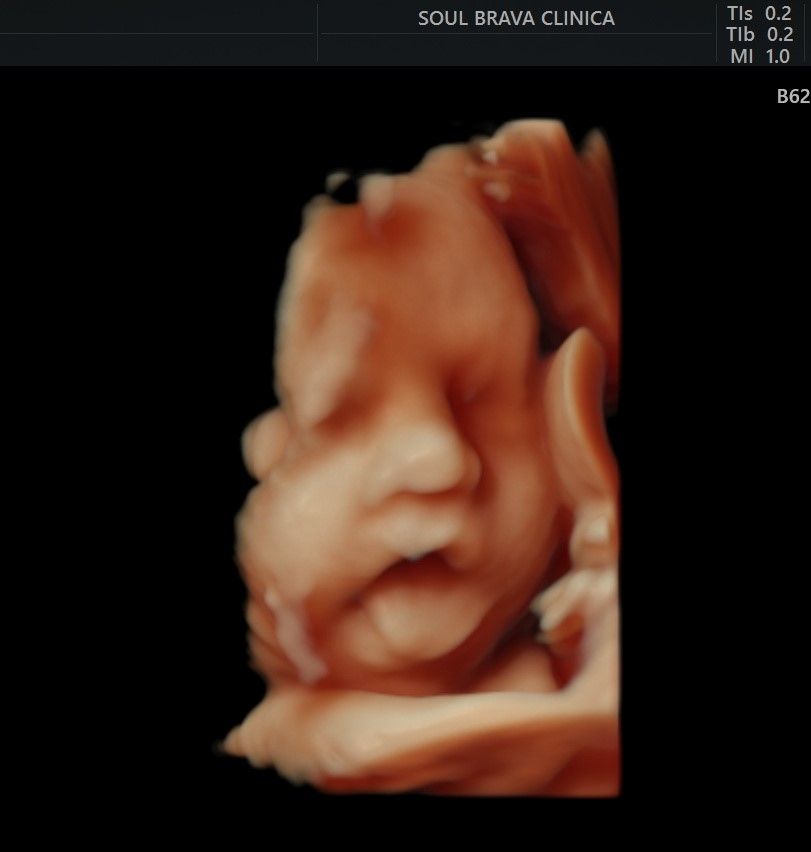 Charles Schwantz De Lima-12