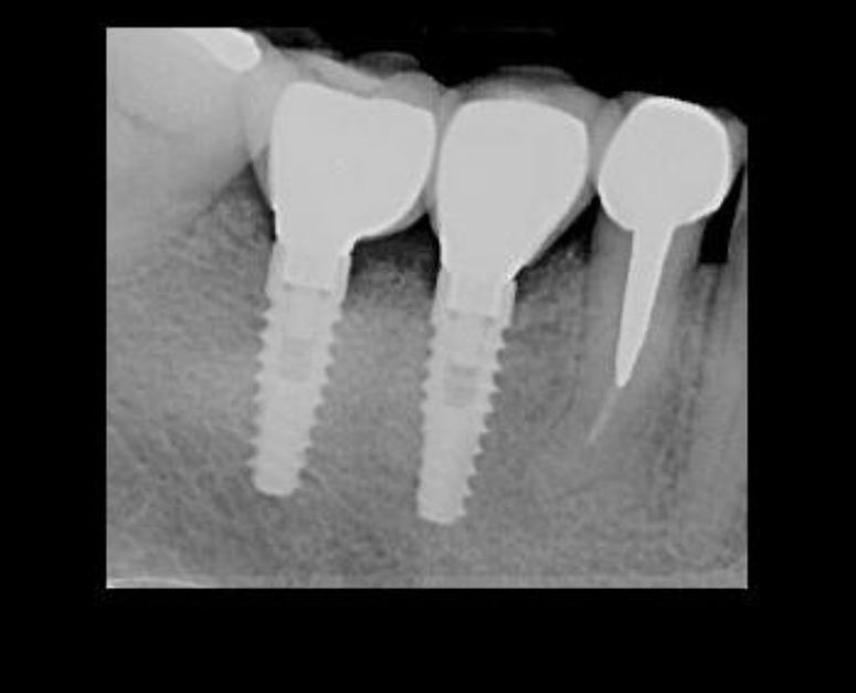Jose Vicente Rocha Fernandez-35