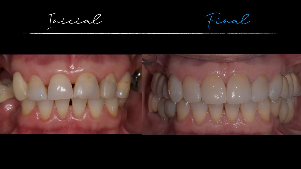 Matías Soto Parra-8