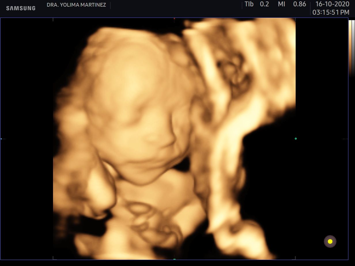 Mercy Yolima Martínez Velásquez-10