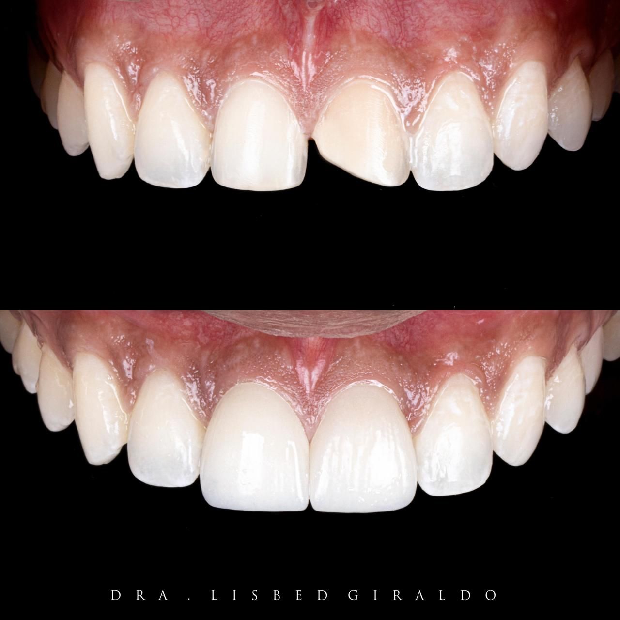 Lisbed Giraldo Olarte-4