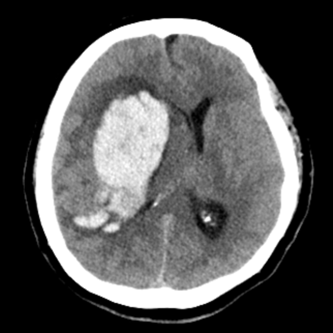 David Tafur Muñoz-2003