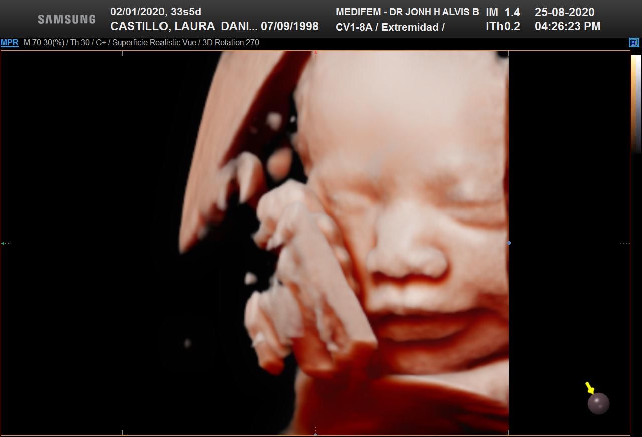 Jonh Harold Alvis Botello-17