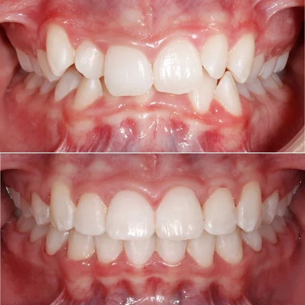 Frank Mendoza Alanya-26