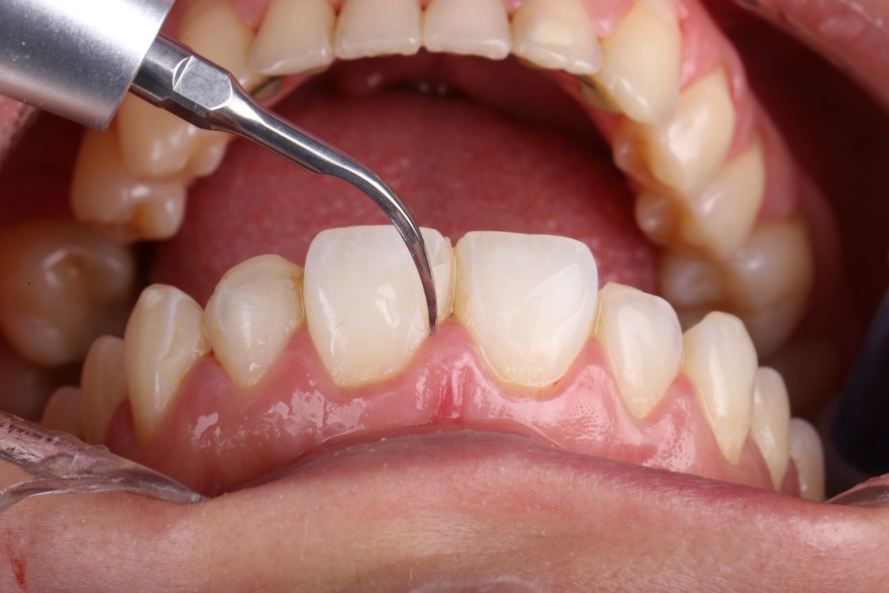 Martin Ignacio Ibañez-3