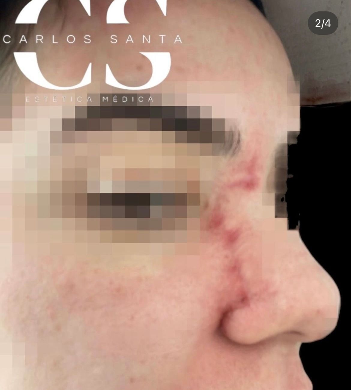 Carlos Andrés Santa-17