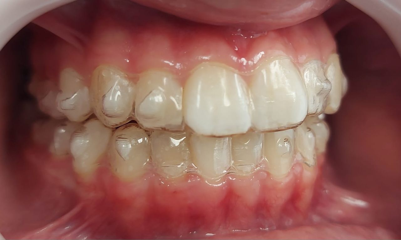 Camila De Loyola E Silva Avellar Fonseca-21