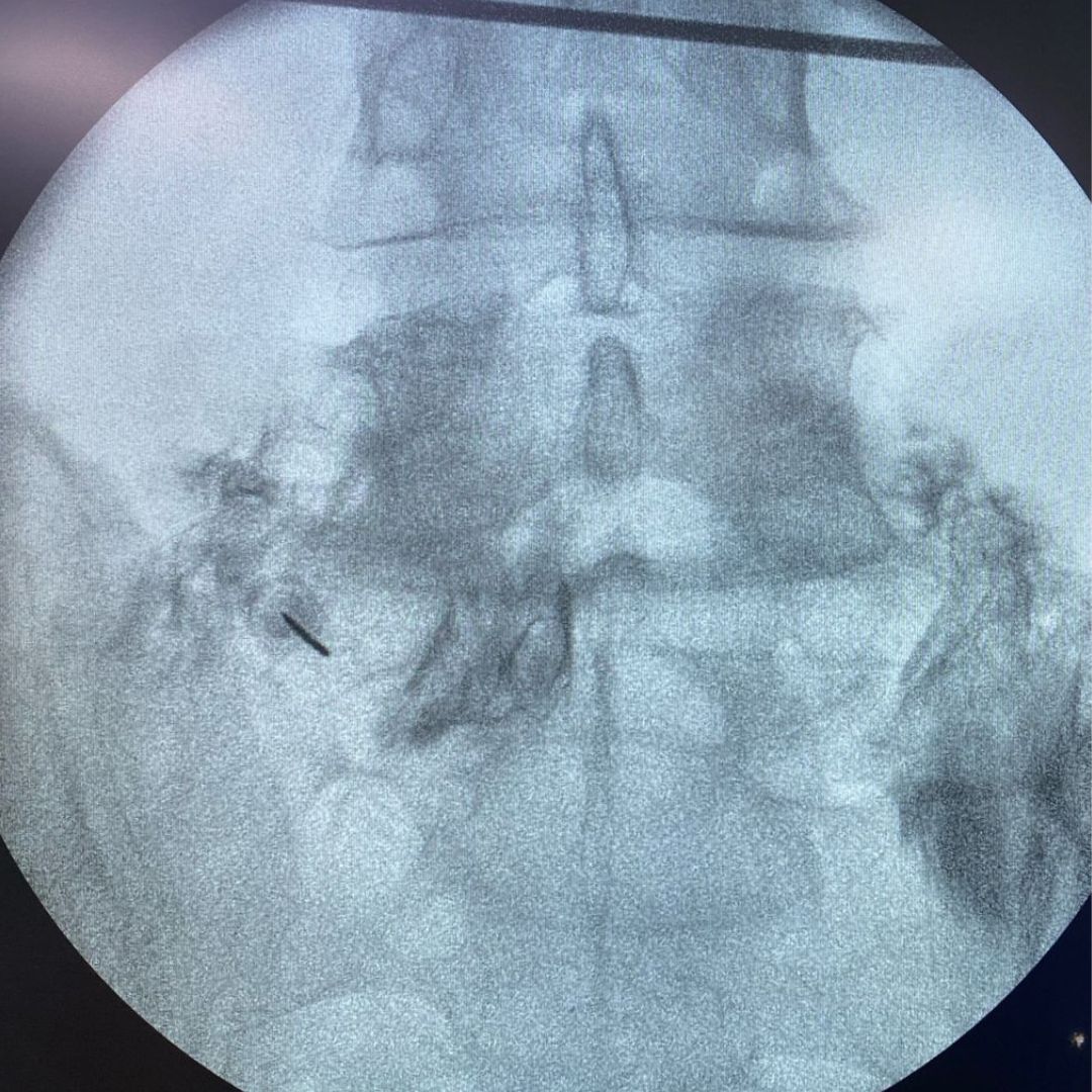 David Tafur Muñoz-2159