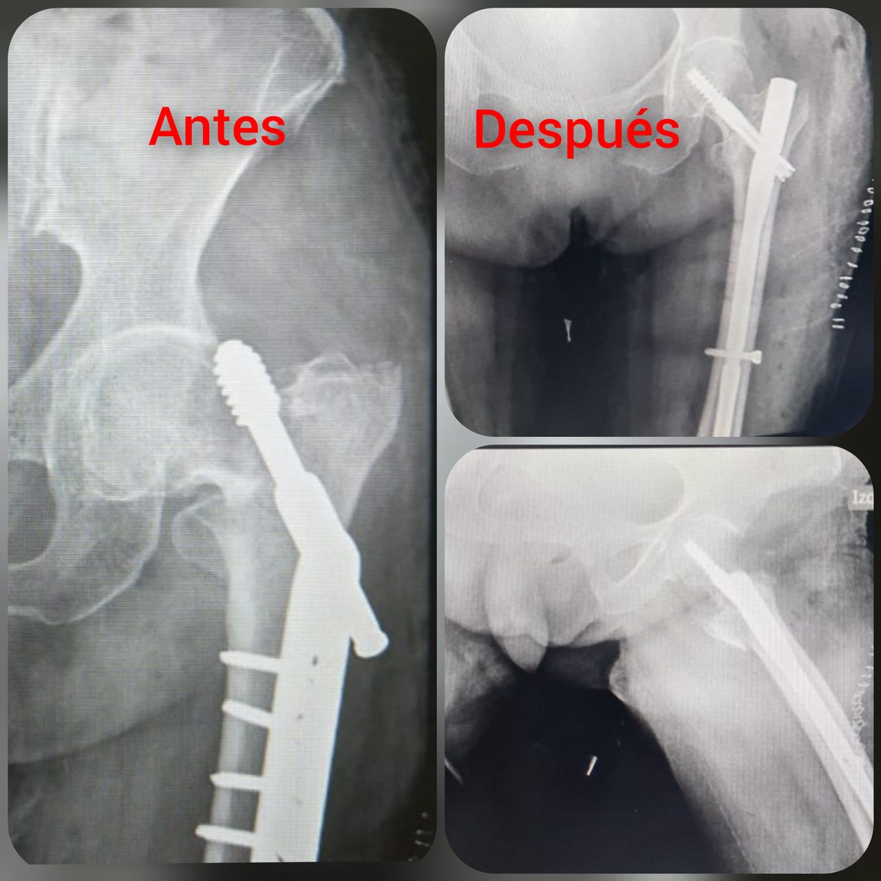 Carlos Escalante Saavedra-20