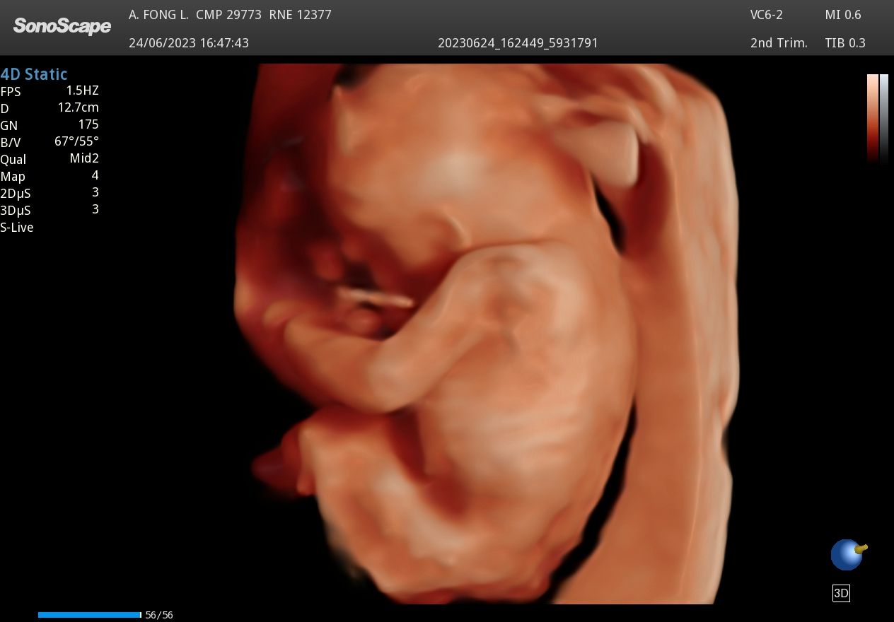 Armando Efren Fong Lei-3