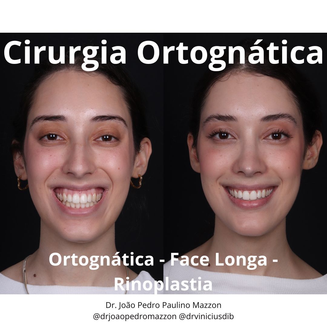 João Pedro Paulino Mazzon-8