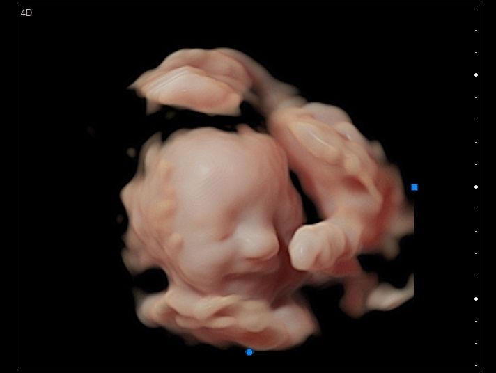 Cesar Vicente Albornoz Moreira-1