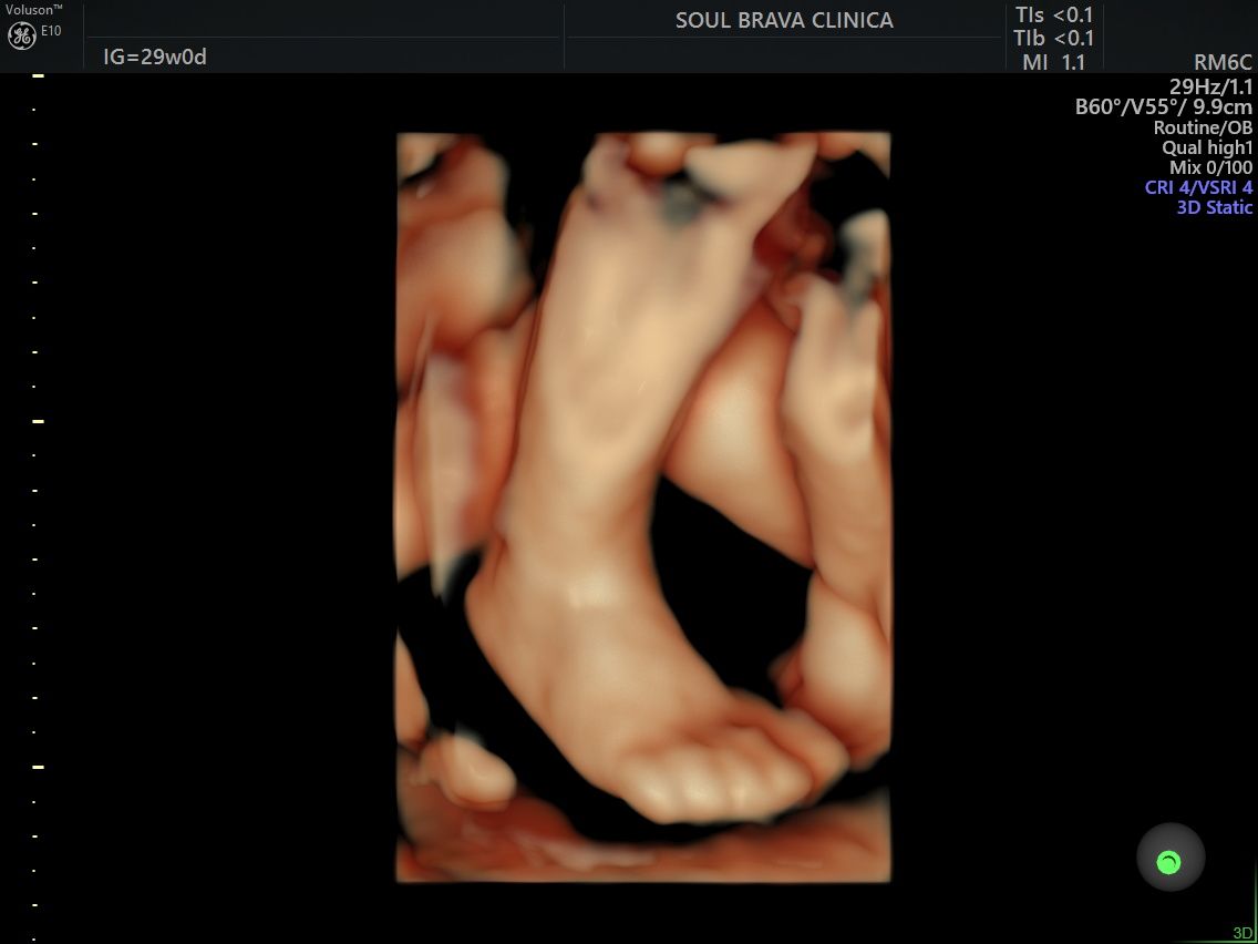 Charles Schwantz De Lima-24