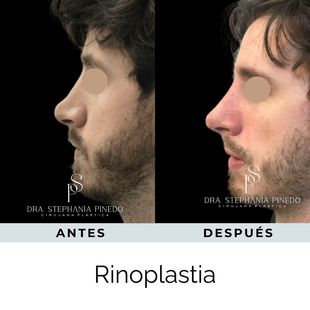 Stephanía Pinedo García-25