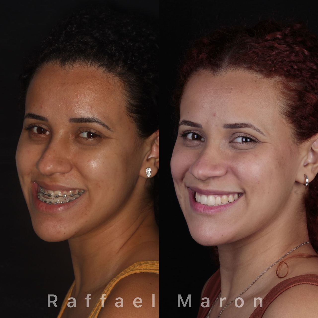 Raffael Maron Vieira De Noronha-18