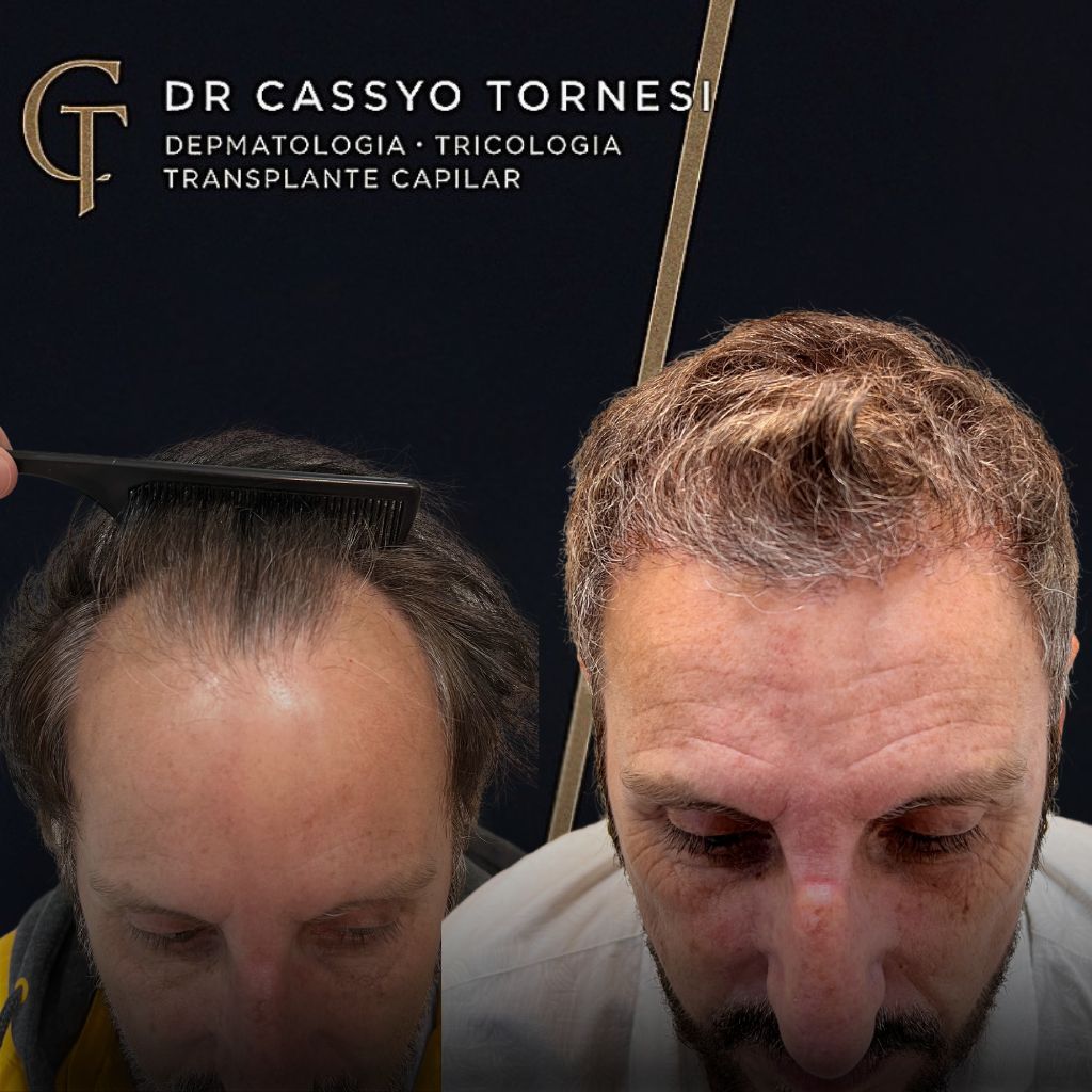 Cassyo Tornesi-16