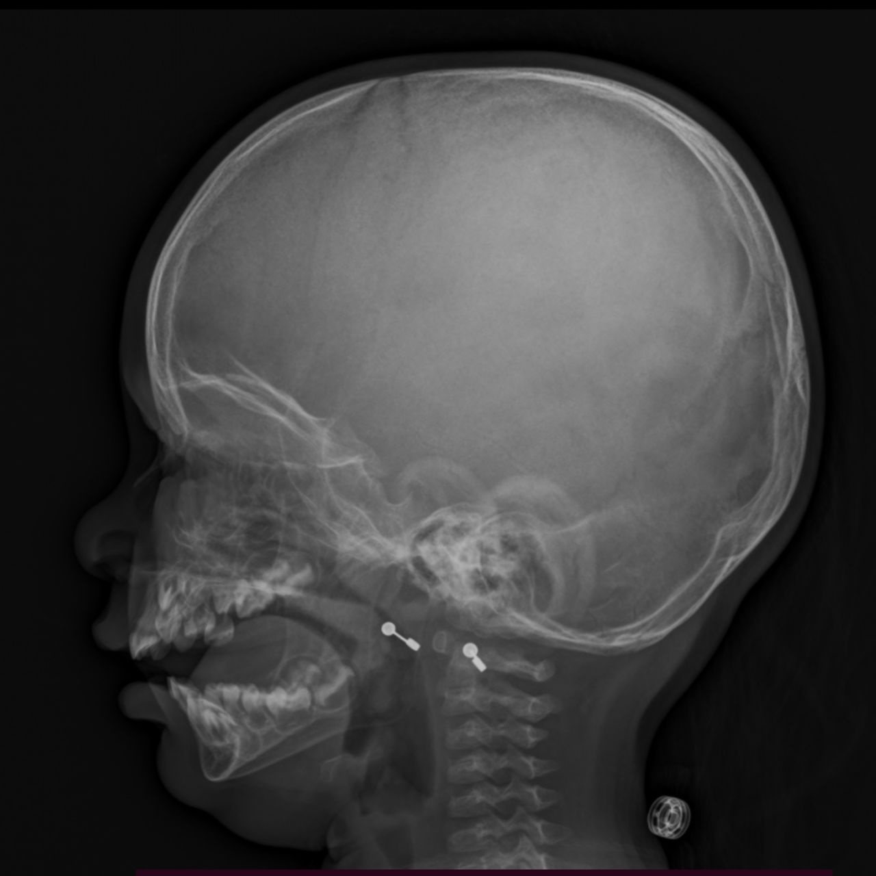 David Tafur Muñoz-1722