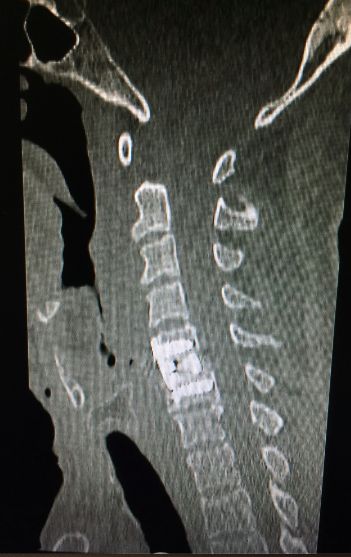 José Lopes Sousa Filho-82