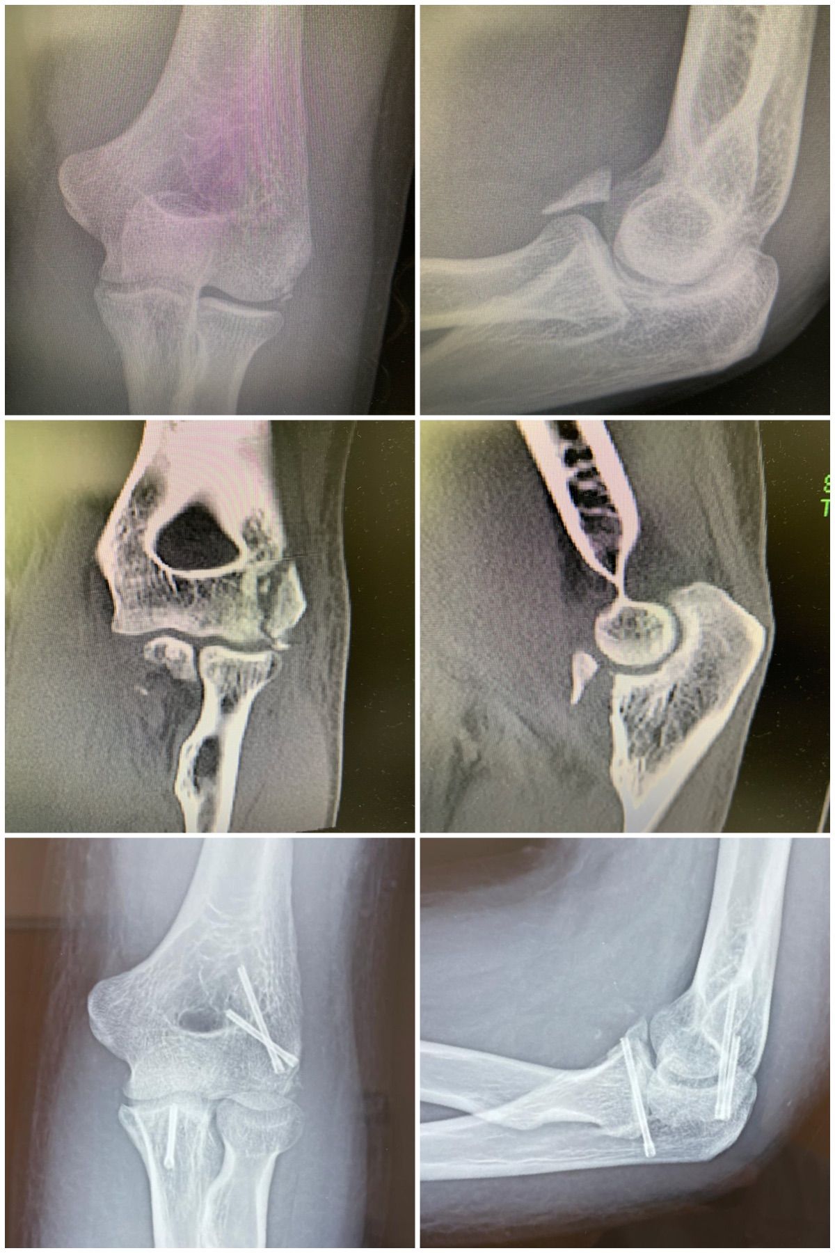 Carlos Moreno Castillo-13