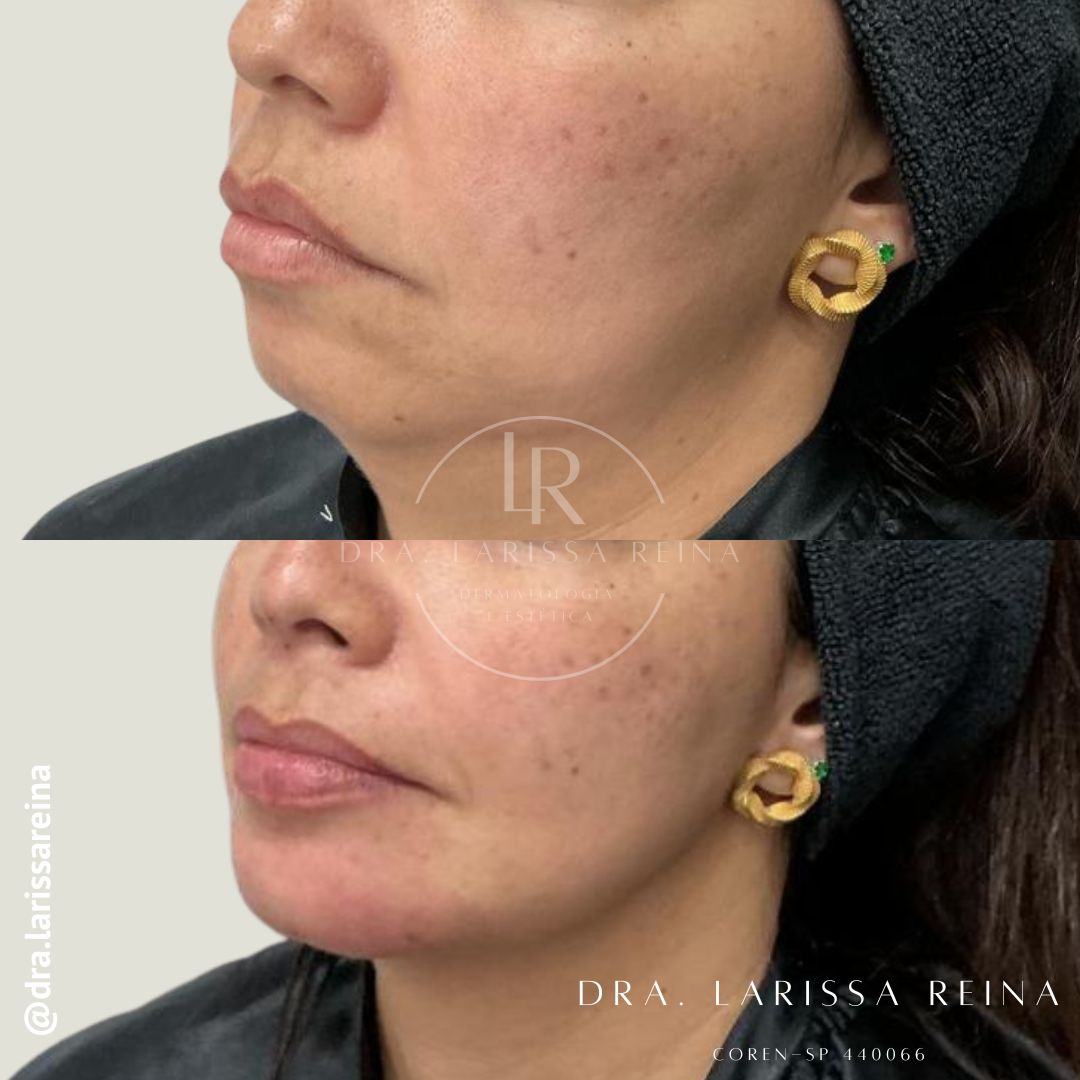 Larissa Reina-11