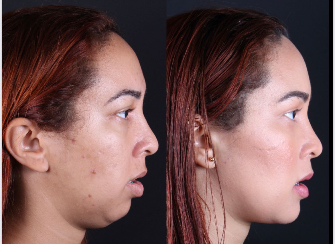 Frederico Carnevale-2