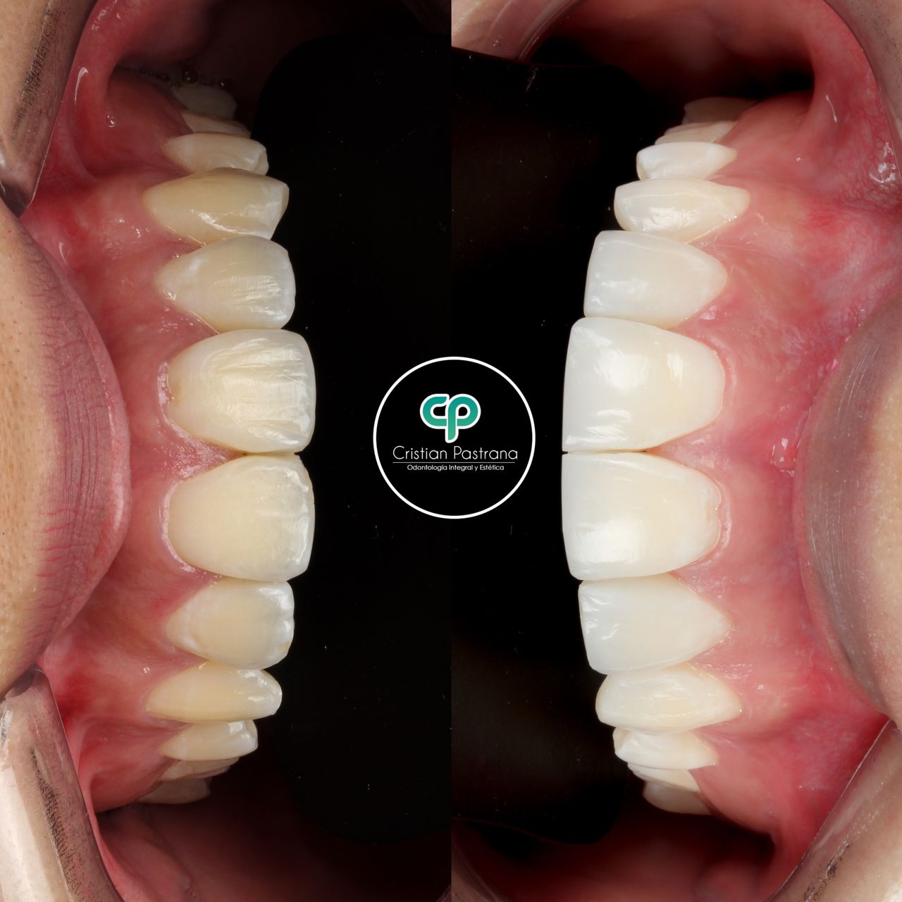 Cristian Pastrana Corrales-11