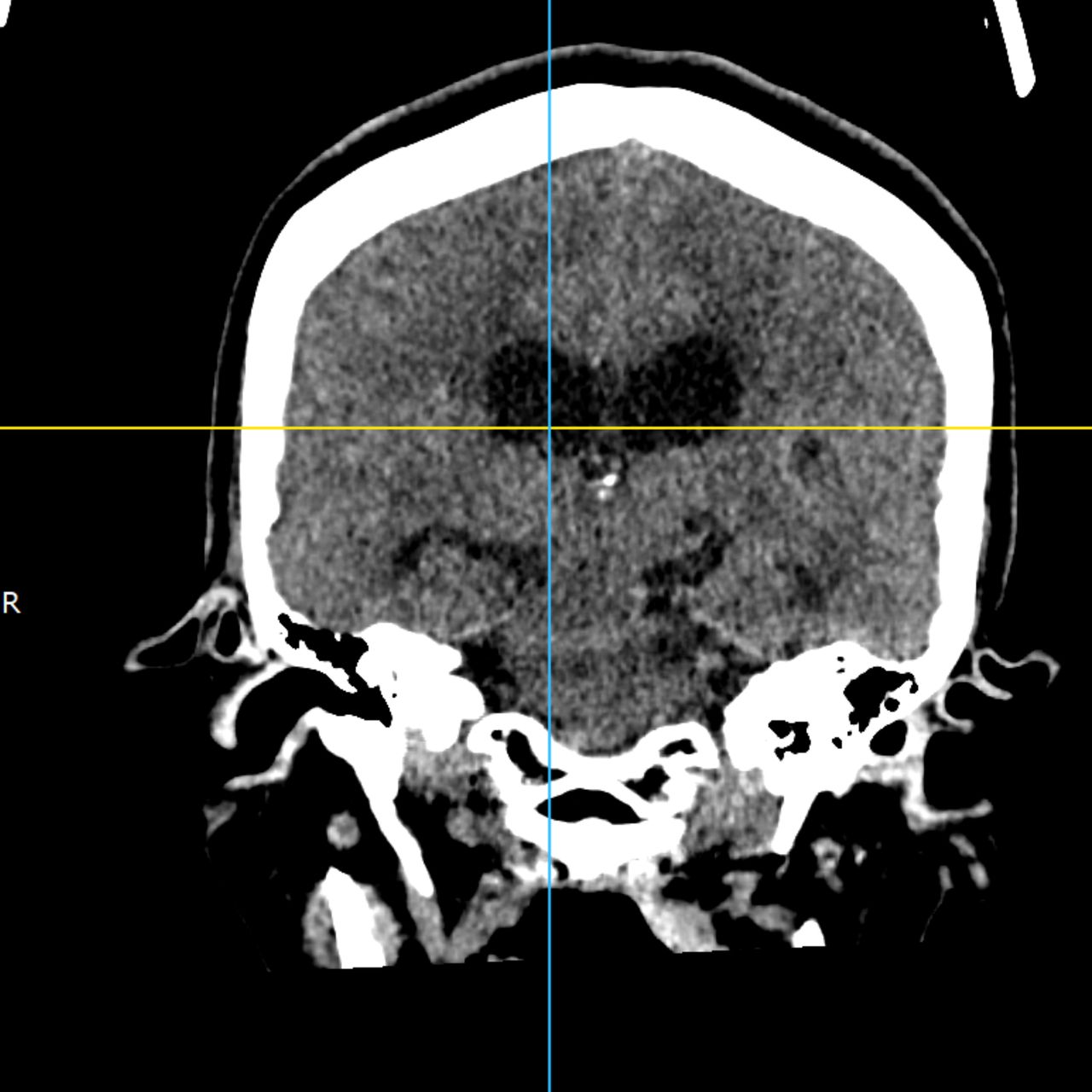 David Tafur Muñoz-1946