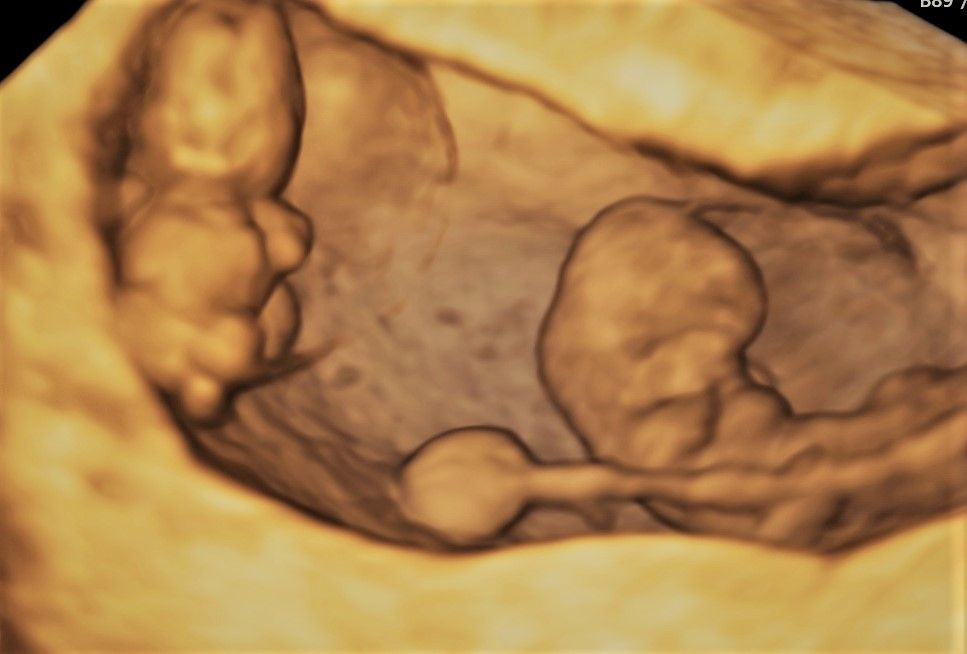 Charles Schwantz De Lima-38