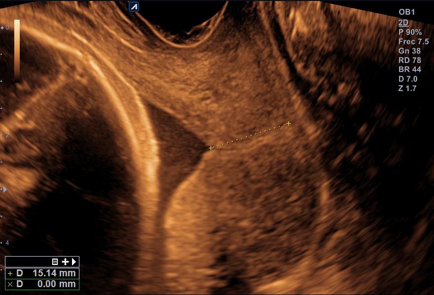 Benjamín Villarroel Castillo-5