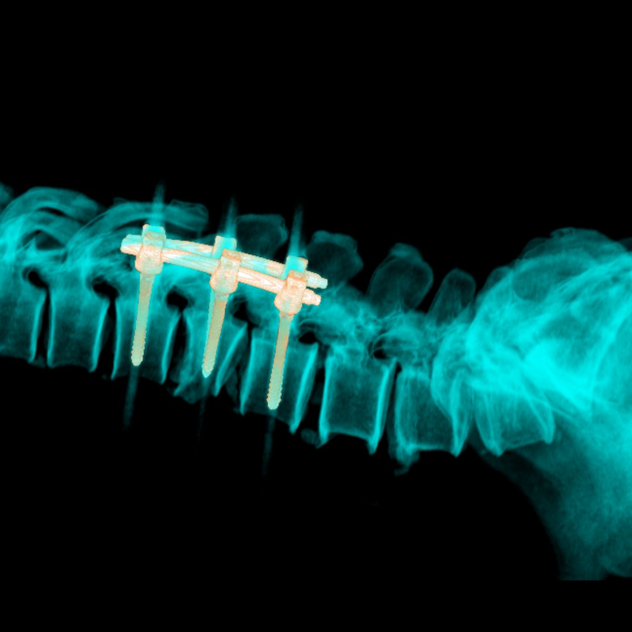 David Tafur Muñoz-2053