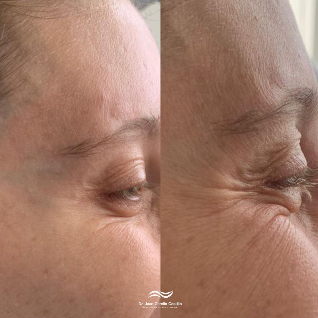 Juan Camilo Castillo-24