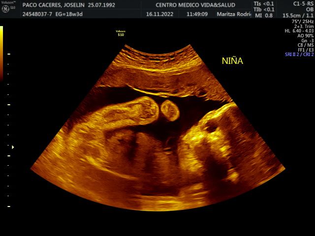 Maritza Rodriguez Balanta-16