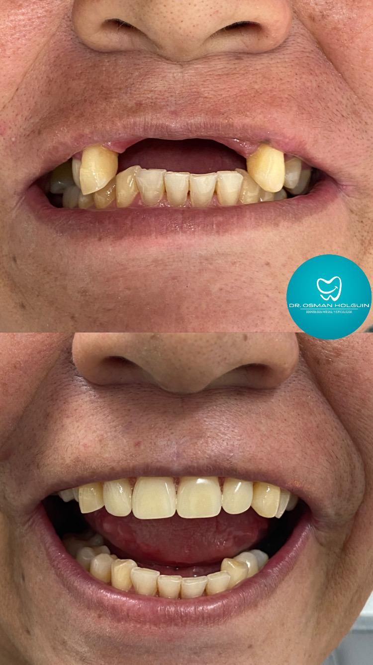 Osman Fernando Holguin Grisales-7