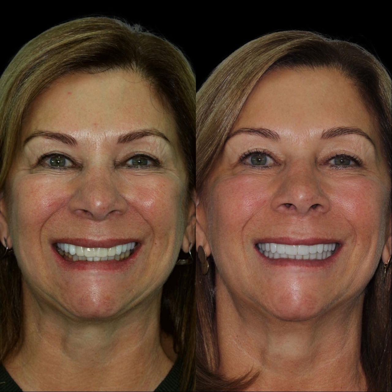 Caroline Benedeti-19