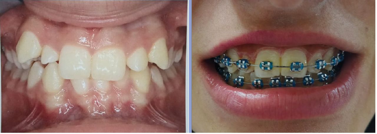 Luisa Fernanda Giraldo-5