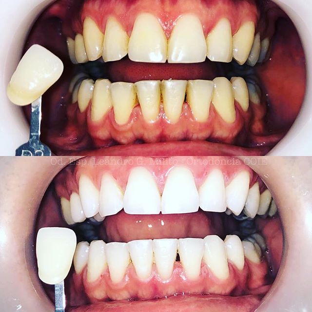 Leandro G. Milito-18