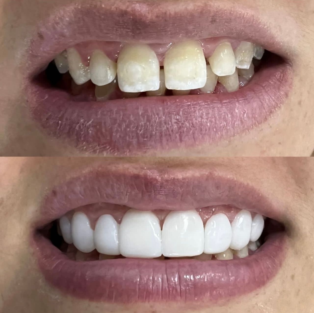 Juan Felipe Sossa Monsalve-7