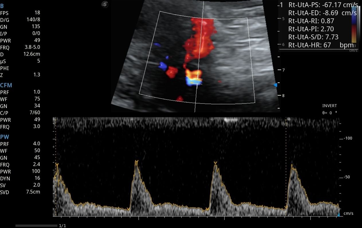 Maite Jesús  Herrera González-6
